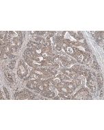 IHC easy ® ANXA11 Ready-To-Use IHC Kit KHC0708 proteintech