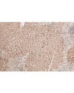 IHC easy ® FUCA1 Ready-To-Use IHC Kit KHC0766 proteintech