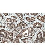 IHC easy ® CDKN1B Ready-To-Use IHC Kit KHC0773 proteintech