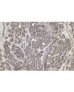 IHC easy ® MMP12 Ready-To-Use IHC Kit KHC0785 proteintech