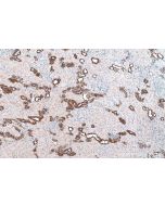 IHC easy ® GSTM3 Ready-To-Use IHC Kit KHC0789 proteintech
