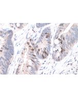 IHC easy ® KPNA2 Ready-To-Use IHC Kit KHC0799 proteintech