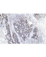 IHC easy ® MMP1 Ready-To-Use IHC Kit KHC0804 proteintech