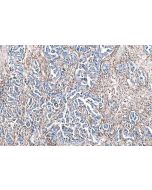 IHC easy ® LGALS1 Ready-To-Use IHC Kit KHC0826 proteintech