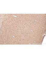IHC easy ® CACYBP Ready-To-Use IHC Kit KHC0868 proteintech