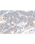 IHC easy ® NENF Ready-To-Use IHC Kit KHC0897 proteintech