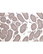 IHC easy ® PRPSAP1 Ready-To-Use IHC Kit KHC0919 proteintech