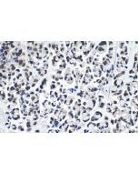 IHC easy ® NUP50 Ready-To-Use IHC Kit KHC0934 proteintech