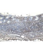 IHC easy ® FCGR2A/CD32A Ready-To-Use IHC Kit KHC0941 proteintech