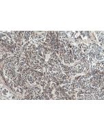 IHC easy ® CD98/SLC3A2 Ready-To-Use IHC Kit KHC0953 proteintech