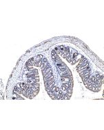 IHC easy ® ARFIP2 Ready-To-Use IHC Kit KHC0980 proteintech