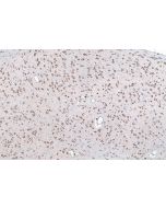 IHC easy ® BTF3L4 Ready-To-Use IHC Kit KHC1009 proteintech
