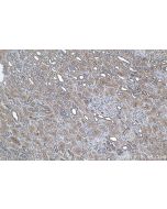 IHC easy ® PPP6C Ready-To-Use IHC Kit KHC1013 proteintech