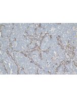 IHC easy ® PRKCDBP/CAVIN3 Ready-To-Use IHC Kit KHC1081 proteintech