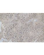 IHC easy ® DC-SIGNR/CD299 Ready-To-Use IHC Kit KHC1127 proteintech