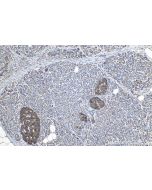 IHC easy ® GRN Ready-To-Use IHC Kit KHC1132 proteintech