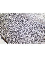 IHC easy ® MYDGF Ready-To-Use IHC Kit KHC1139 proteintech