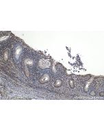 IHC easy ® PSME1 Ready-To-Use IHC Kit KHC1142 proteintech