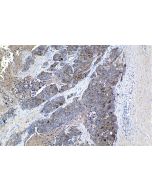 IHC easy ® HE4 Ready-To-Use IHC Kit KHC1165 proteintech