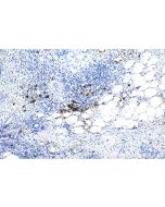 IHC easy ® DEFA1 Ready-To-Use IHC Kit KHC1167 proteintech