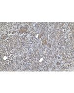 IHC easy ® TRIM21 Ready-To-Use IHC Kit KHC1177 proteintech
