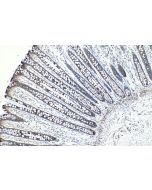 IHC easy ® MAP7 Ready-To-Use IHC Kit KHC1236 proteintech