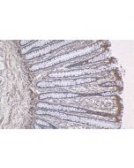 IHC easy ® RNF6 Ready-To-Use IHC Kit KHC1243 proteintech