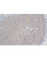 IHC easy ® JAK1 Ready-To-Use IHC Kit KHC1264 proteintech