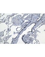 IHC easy ® SNRPA1 Ready-To-Use IHC Kit KHC1306 proteintech