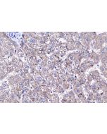 IHC easy ® HPDL Ready-To-Use IHC Kit KHC1307 proteintech