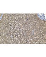 IHC easy ® HIBCH Ready-To-Use IHC Kit KHC1310 proteintech