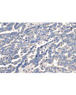 IHC easy ® DSE Ready-To-Use IHC Kit KHC1340 proteintech