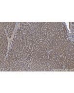 IHC easy ® IGF2R Ready-To-Use IHC Kit KHC1361 proteintech