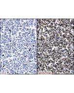 IHC easy ® Phospho-Histone H3 (Ser10) Ready-To-Use IHC Kit KHC1439 proteintech