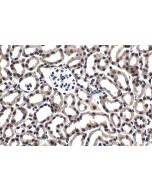 IHC easy ® BRD4 Ready-To-Use IHC Kit KHC1470 proteintech