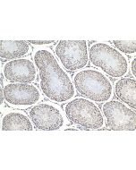 IHC easy ® SRSF10 Ready-To-Use IHC Kit KHC1475 proteintech