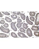 IHC easy ® KAT7/MYST2 Ready-To-Use IHC Kit KHC1491 proteintech