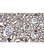 IHC easy ® CNOT4 Ready-To-Use IHC Kit KHC1497 proteintech