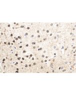 IHC easy ® FGF2 Ready-To-Use IHC Kit KHC1516 proteintech