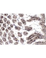 IHC easy ® HIVEP1 Ready-To-Use IHC Kit KHC1535 proteintech