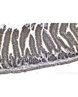 IHC easy ® PSMA3 Ready-To-Use IHC Kit KHC1563 proteintech