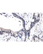 IHC easy ® ARNT Ready-To-Use IHC Kit KHC1568 proteintech