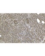 IHC easy ® PPM1A Ready-To-Use IHC Kit KHC1586 proteintech