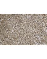 IHC easy ® STAT5A Ready-To-Use IHC Kit KHC1594 proteintech