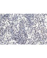 IHC easy ® CTCF Ready-To-Use IHC Kit KHC1613 proteintech