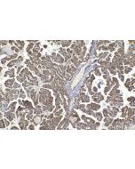 IHC easy ® PSMB2 Ready-To-Use IHC Kit KHC1615 proteintech