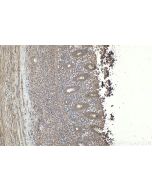 IHC easy ® DGKQ Ready-To-Use IHC Kit KHC1623 proteintech