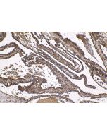 IHC easy ® PRKAA2 Ready-To-Use IHC Kit KHC1628 proteintech