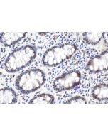 IHC easy ® CTBP2 Ready-To-Use IHC Kit KHC1633 proteintech