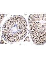 IHC easy ® HSF1 Ready-To-Use IHC Kit KHC1658 proteintech
